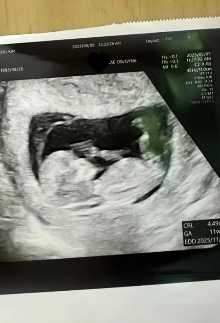 트루디, 이대은, 임신, 결혼, 야구