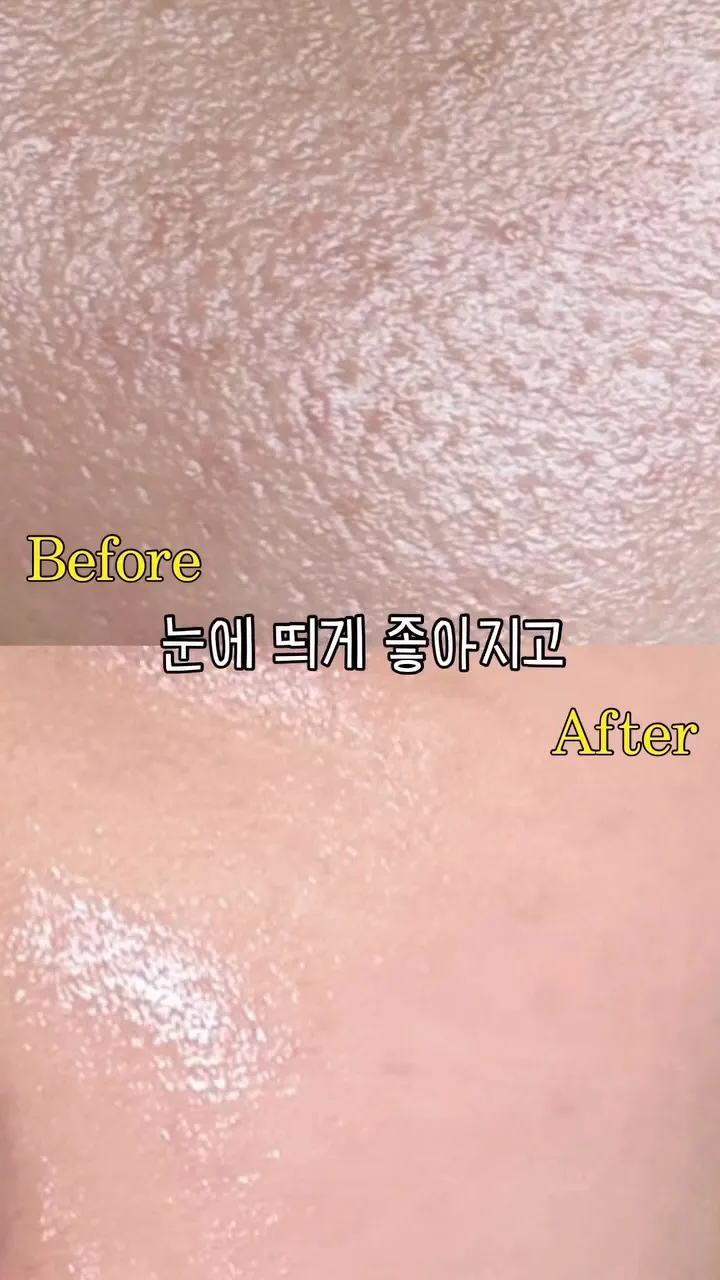 “Làn da khỏe mạnh” Sanbeom tiết lộ bí quyết chăm sóc lỗ chân lông