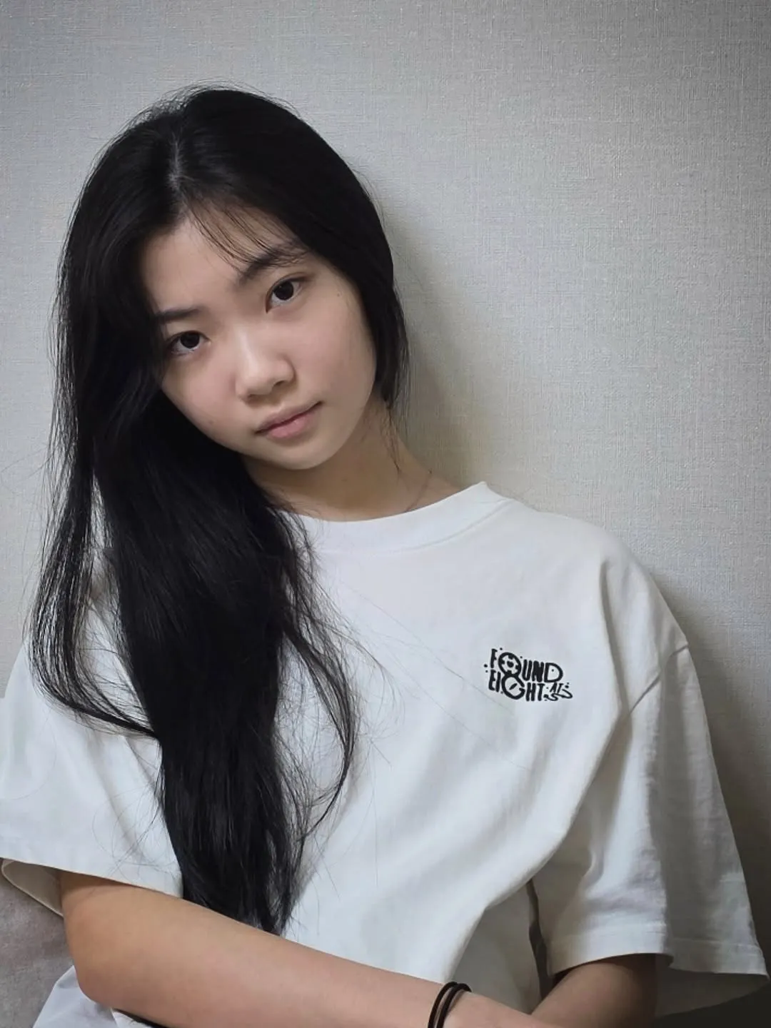 金泰妍, 歌手, Instagram, 照片, 手指受伤