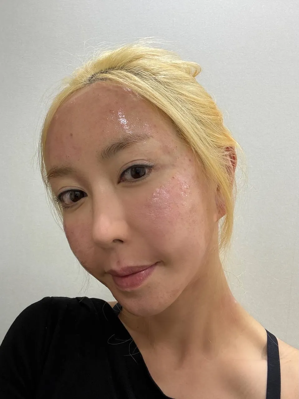 ชู แห่ง S.E.S. แชร์ทิปดูแลผิว เน้นผลลัพธ์จากใบบัวบกหลังเลเซอร์