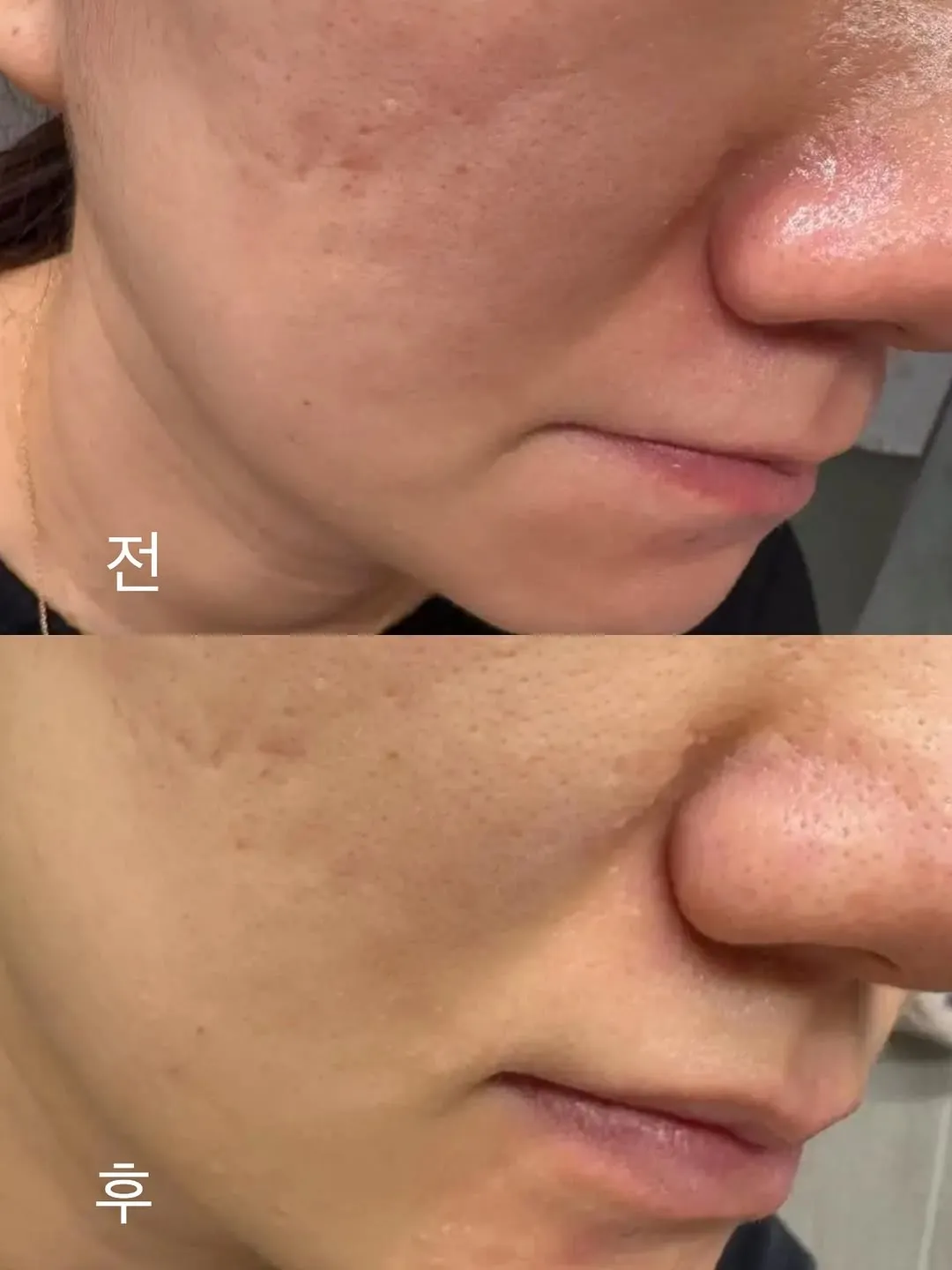 洪英琪, 美妆博主, 保湿系列, 镇静舒缓, Instagram