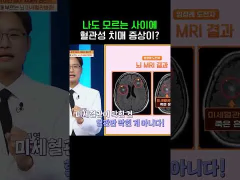 혈관성 치매의 진실, 몸신의 탄생에서 밝히다