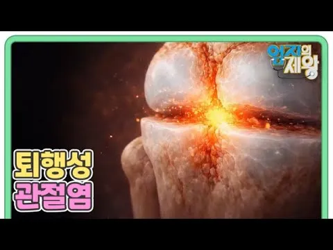 如何战胜退行性关节炎：从MBN节目视频中寻找的应对之道