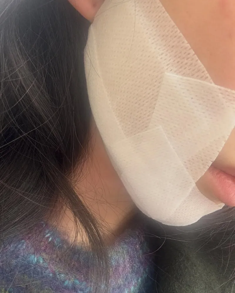 Kwon Mina vive un infierno tras efectos adversos por un tratamiento de piel