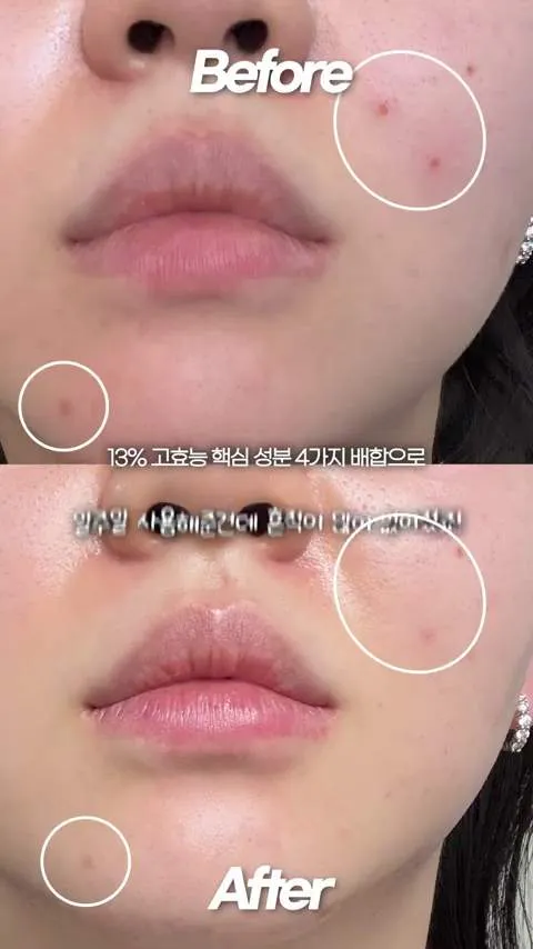 Promoção da Olive Young, Pele de ovo, Layerlab, Barreira cutânea, K-makeup, K-beauty, Layerlab, Clear Serum para Manchas, Sérum de alta performance