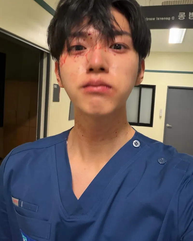 'O Repolho da Sua Vida' Lee Jin-woo deixa o ar juvenil e se consagra como 'ator completo'