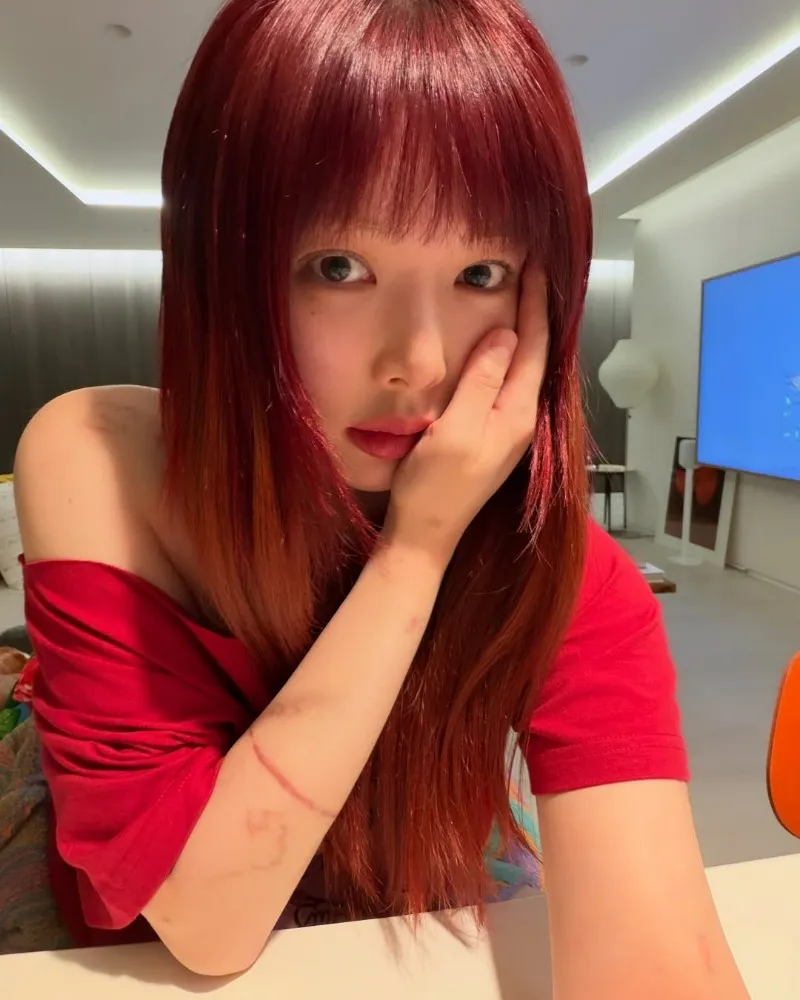 “龙俊亨♥”泫雅，卷入怀孕传闻后…最新近况脸颊肉不见了