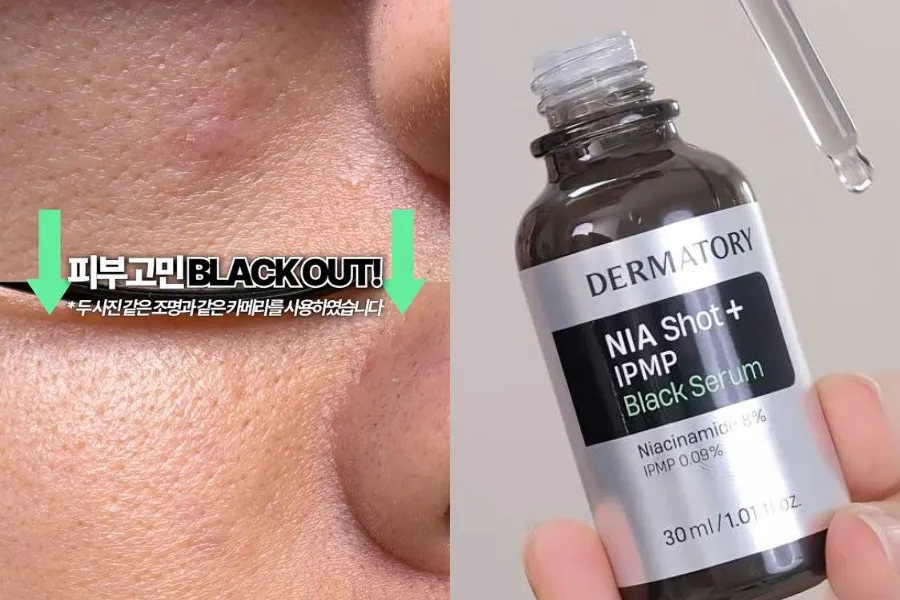 DERMATORY德瑪托莉