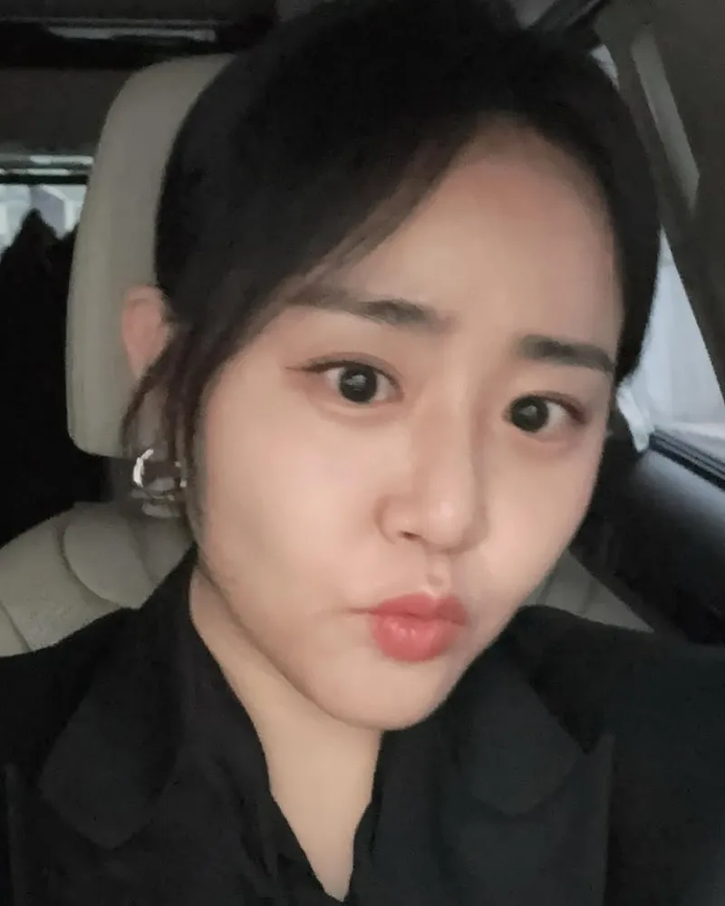 Moon Geun Young yang telah mengatasi sindrom kompartemen akut, tampil 180 derajat berbeda dengan visual lebih ramping