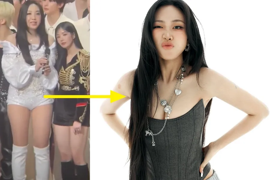 Lee Young-ji Says She’d “Never Stand Next to Her Again” — Viral Two-Shot With Kwon Eun-bi Stirs Buzz