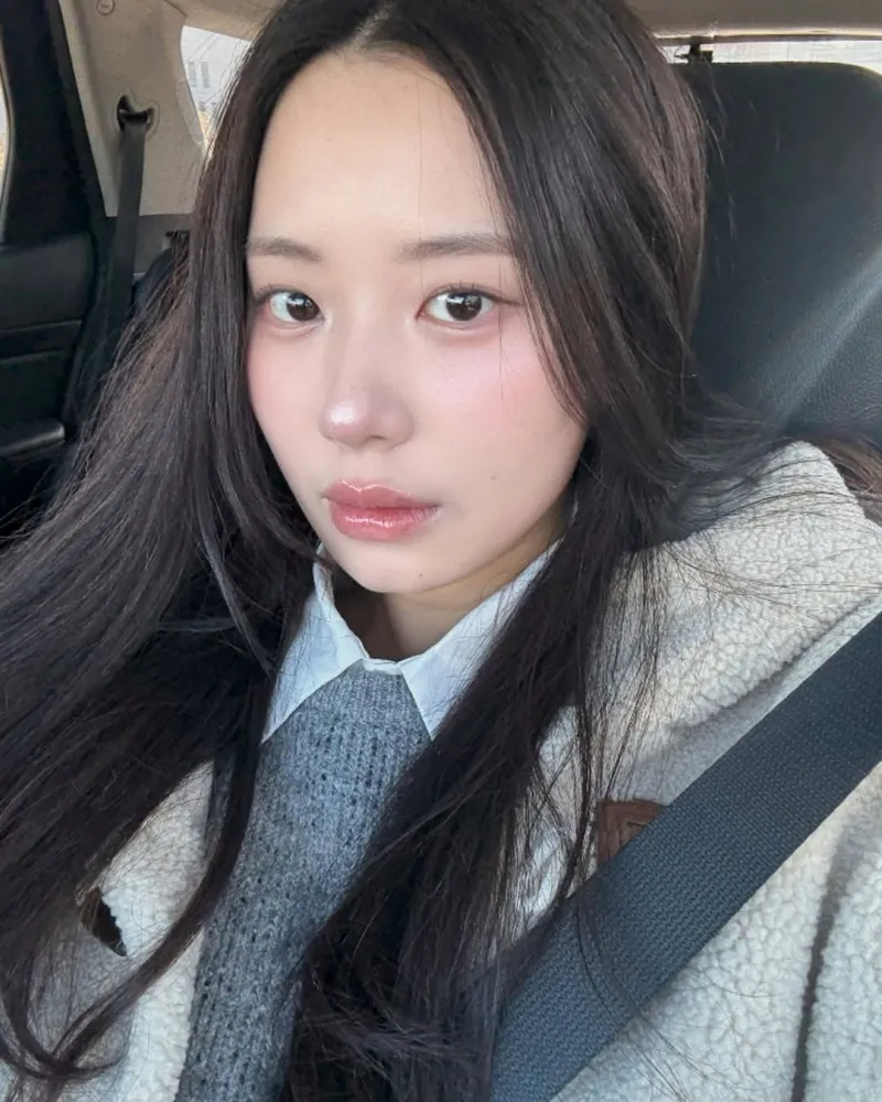 "Desde que estoy embarazada, mi piel se arruinó": Choi Yeon-su se sincera sobre lo que siente