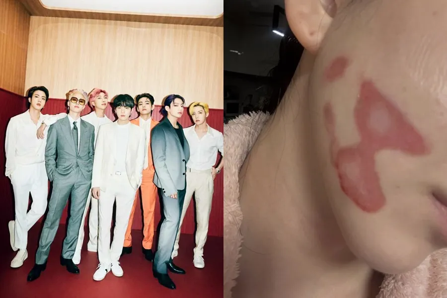 [周末热点] 防弹少年团光化门演出“预约日程”公布…权珉娥控诉术后副作用