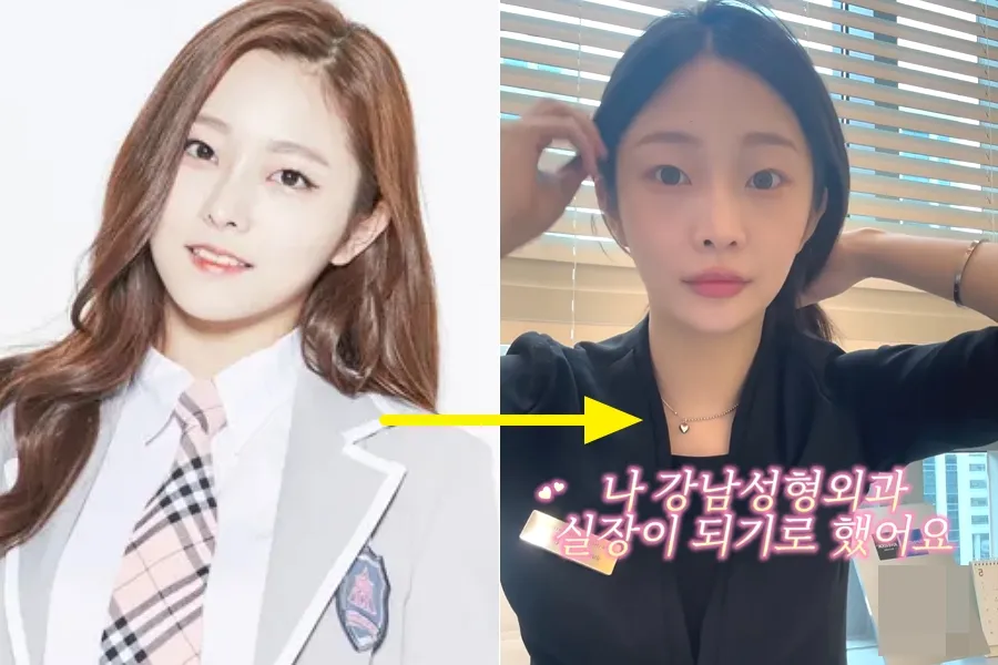 Kabar terbaru Jung Eunwoo eks PRISTIN: "Jadi manajer di klinik bedah plastik Gangnam"