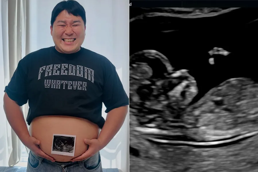 ‘Comedy Big League’ Alum Park Kyung-ho To Become A Dad One Year After Marriage: “Mollppang-i, See You Soon”