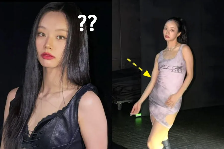 Hyeri turun tangan soal 'polemik perut buncit' yang tak pada tempatnya: "Kenapa harus kurus baru disebut profesional?"