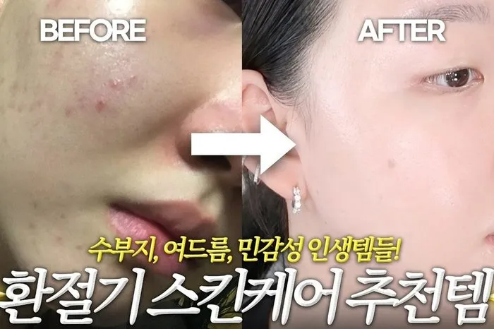 [Kメイク] 季節の変わり目スキンケア、どうやればいいの…「おすすめアイテム」を公開